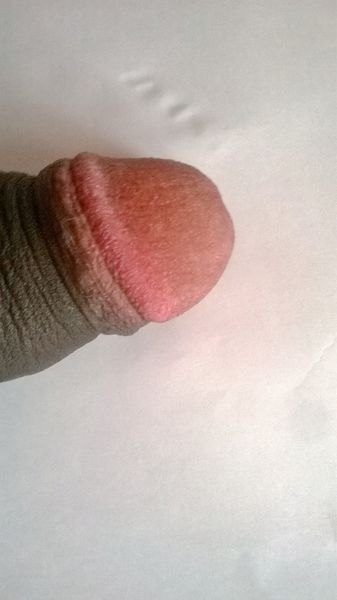 File:029williams - black glans penis.jpeg
