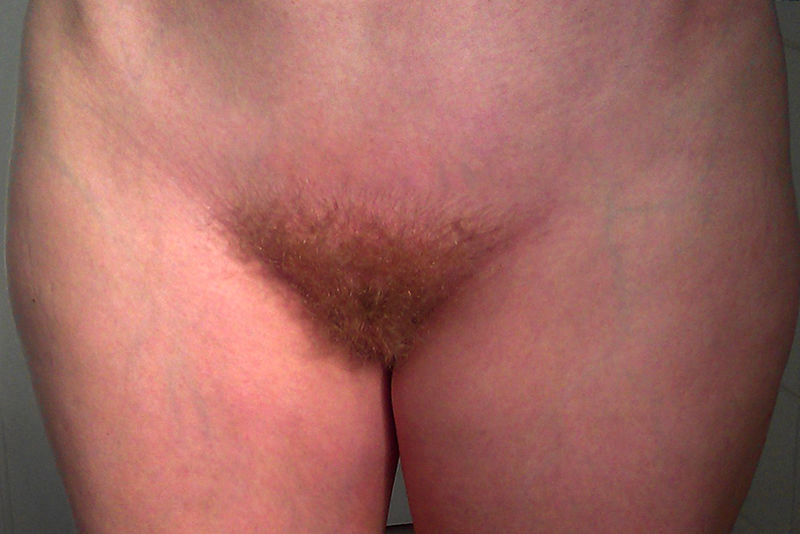 File:Andy.boge - ginger.pubic.hair.jpeg