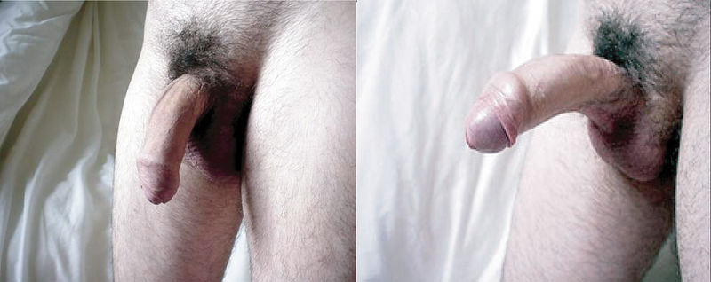 File:BukanTeamBiasa - Foreskin Intact.jpeg