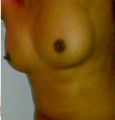 Chunki - Girl breast.jpeg