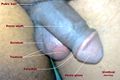 kal - young male penis anatomy.jpeg